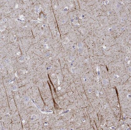 NF-L Antibody