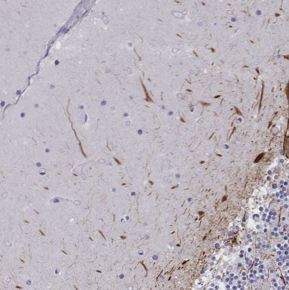 NF-L Antibody