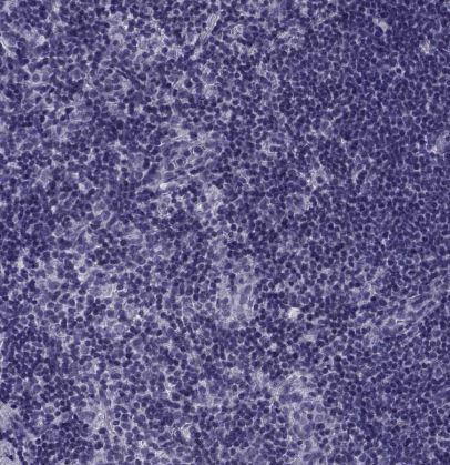 NF-L Antibody
