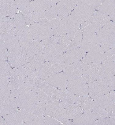 NF-L Antibody