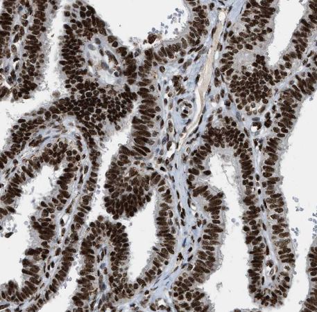 NuMA Antibody