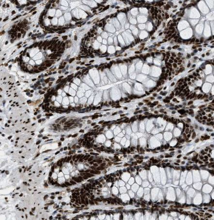 NuMA Antibody