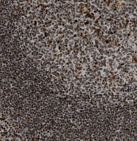 NuMA Antibody