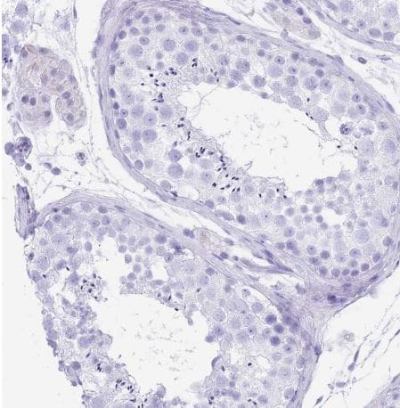 OATP1B3/SLCO1B3/OATP8 Antibody