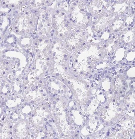 OATP1B3/SLCO1B3/OATP8 Antibody
