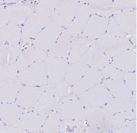 OATP1B3/SLCO1B3/OATP8 Antibody