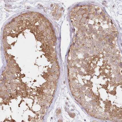 Aminopeptidase B/RNPEP Antibody