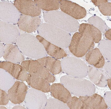 Aminopeptidase B/RNPEP Antibody