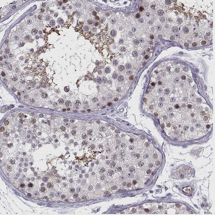 BACH1 Antibody
