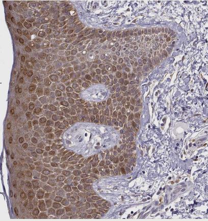 BACH1 Antibody