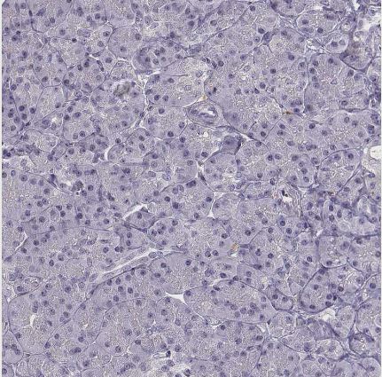 BACH1 Antibody