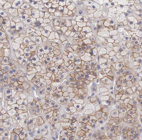 SLITRK4 Antibody