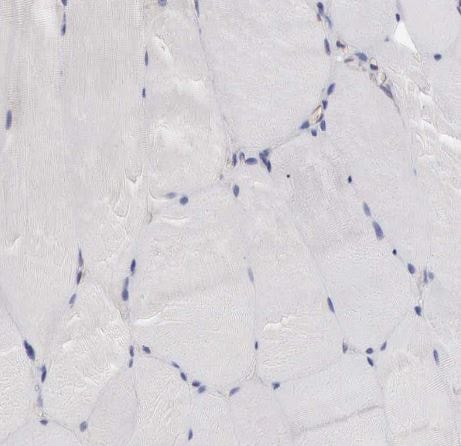 SLITRK4 Antibody