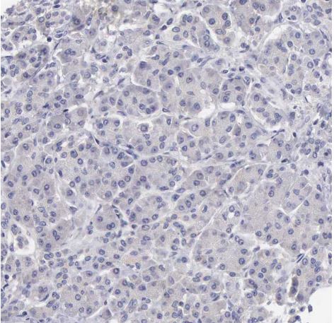 SLITRK4 Antibody
