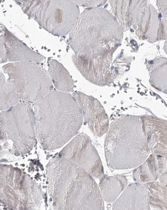 RASSF6 Antibody - BSA Free