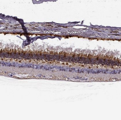 GCAP1 Antibody