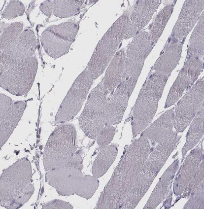 GCAP1 Antibody