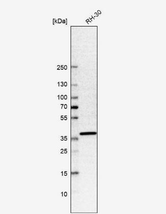 SHISA2 Antibody