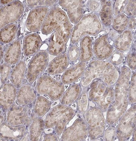 CRB1 Antibody CRB1 Antibody