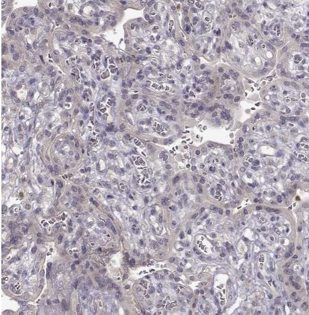 CRB1 Antibody CRB1 Antibody