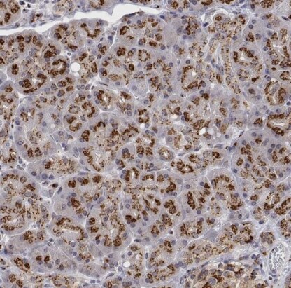 YIPF3 Antibody