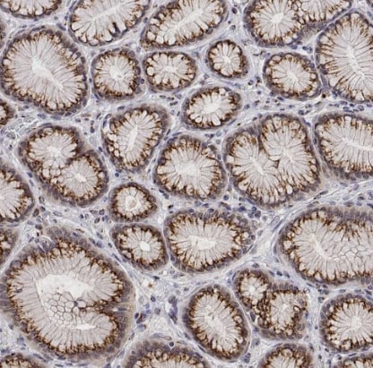 YIPF3 Antibody