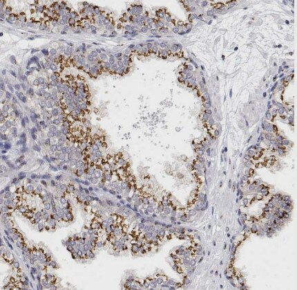 YIPF3 Antibody