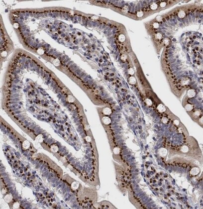 YIPF3 Antibody