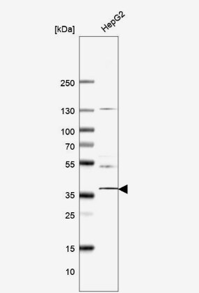 YIPF3 Antibody