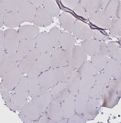 Bestrophin 1 Antibody