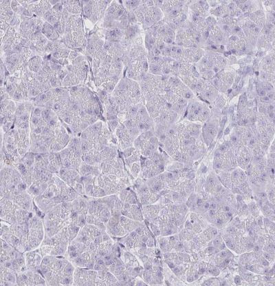 Bestrophin 1 Antibody