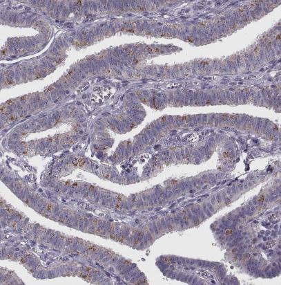 RIMS2 Antibody