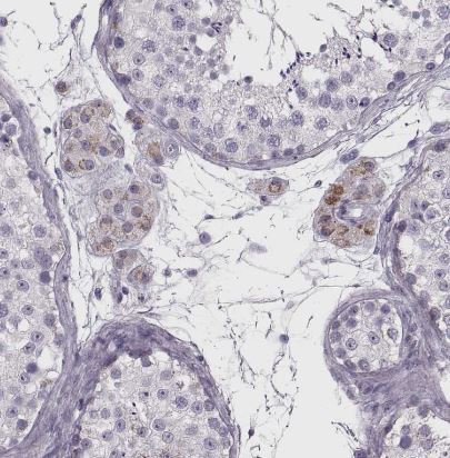RIMS2 Antibody