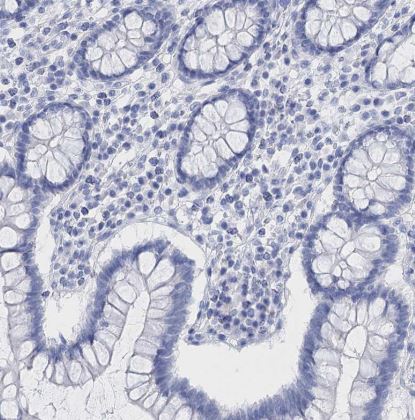 Lactalbumin Alpha Antibody