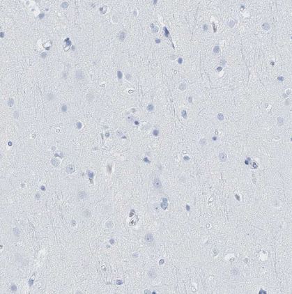 Lactalbumin Alpha Antibody