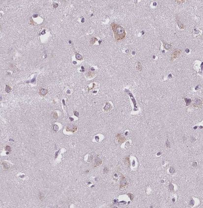 NAALADase-2/NAALAD2 Antibody