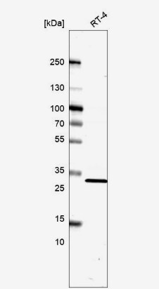 TMEM81 Antibody
