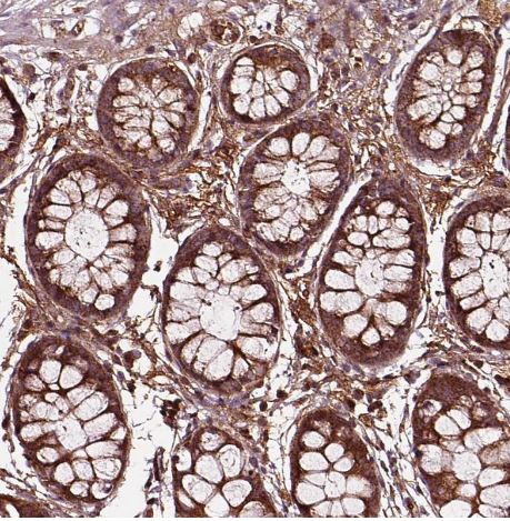 FAM21A Antibody