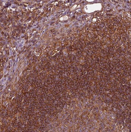 FAM21A Antibody