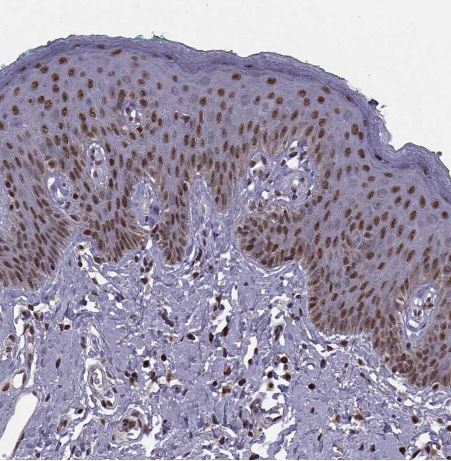 INT3 Antibody