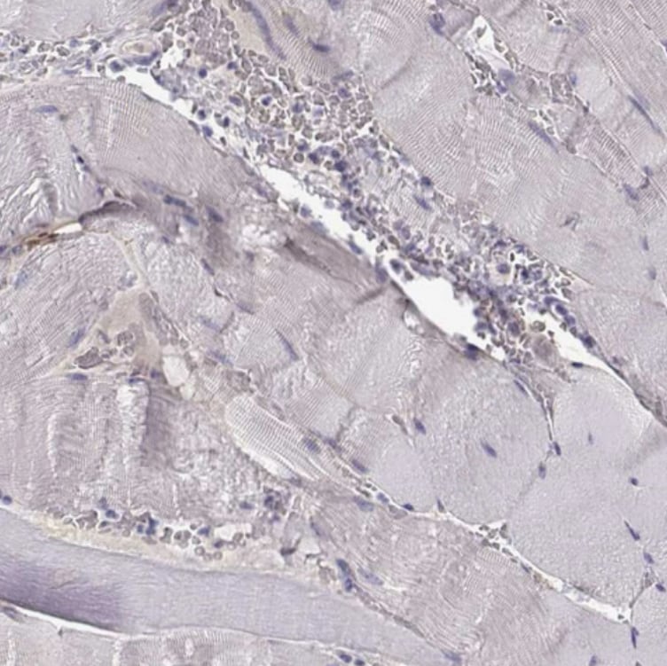 LINGO-1 Antibody - BSA Free
