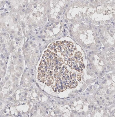 ROM1 Antibody