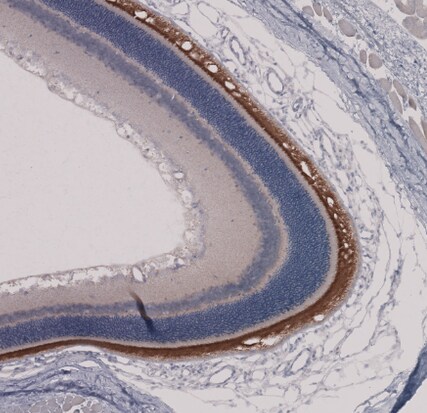 ROM1 Antibody