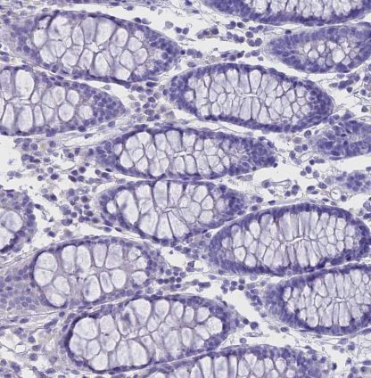 G gamma14 Antibody