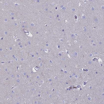 G gamma14 Antibody