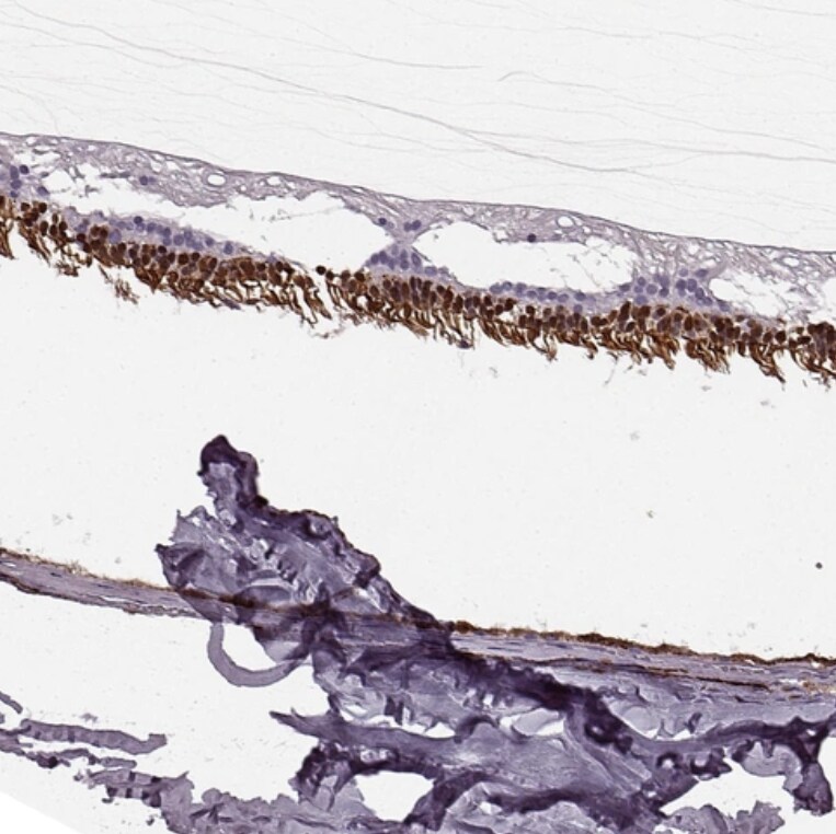 Recoverin Antibody - BSA Free