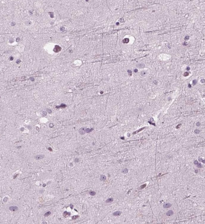 Recoverin Antibody - BSA Free