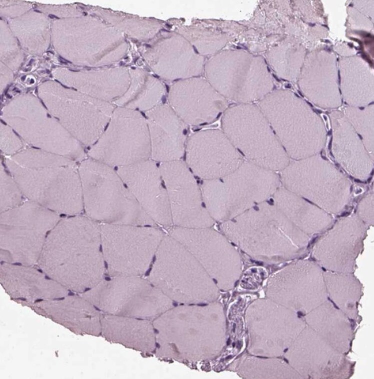Recoverin Antibody - BSA Free