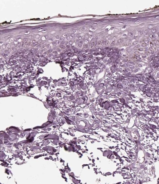 Recoverin Antibody - BSA Free