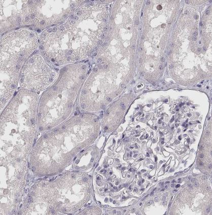 VMAT1/SLC18A1 Antibody